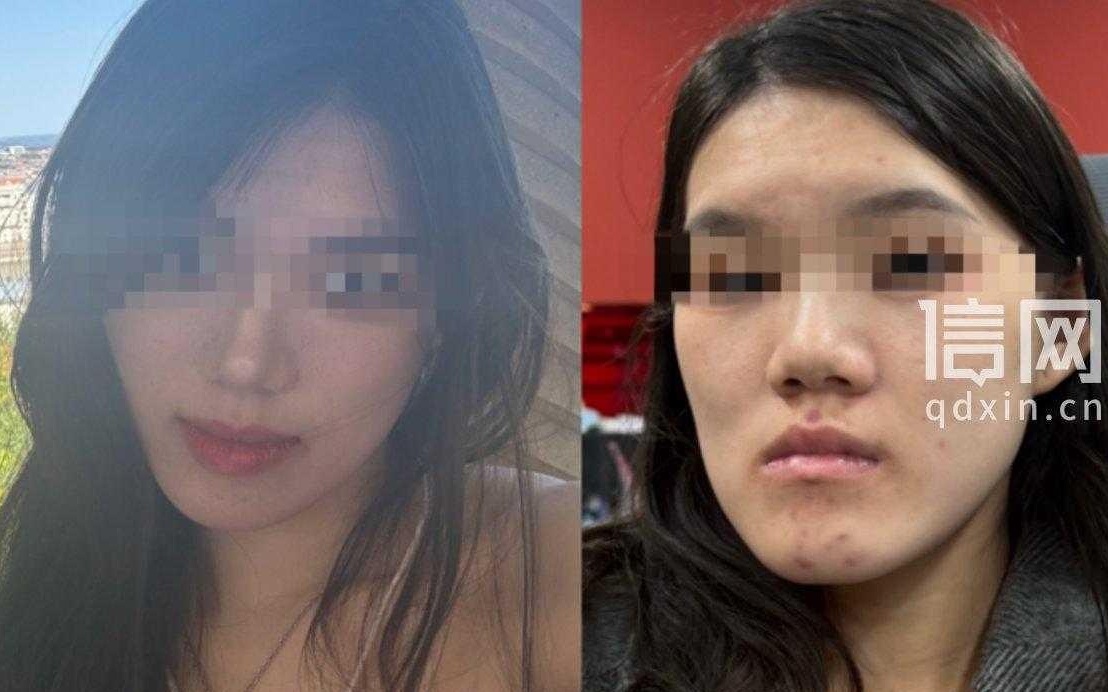 图