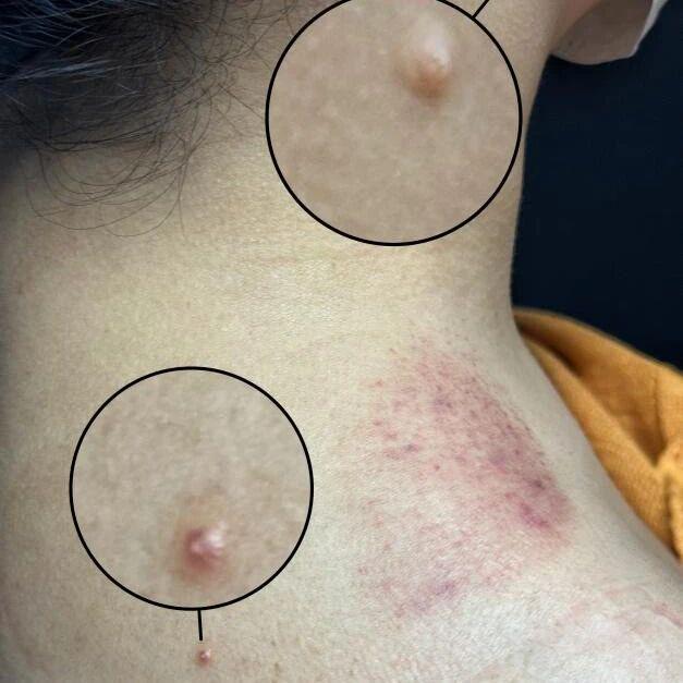 图