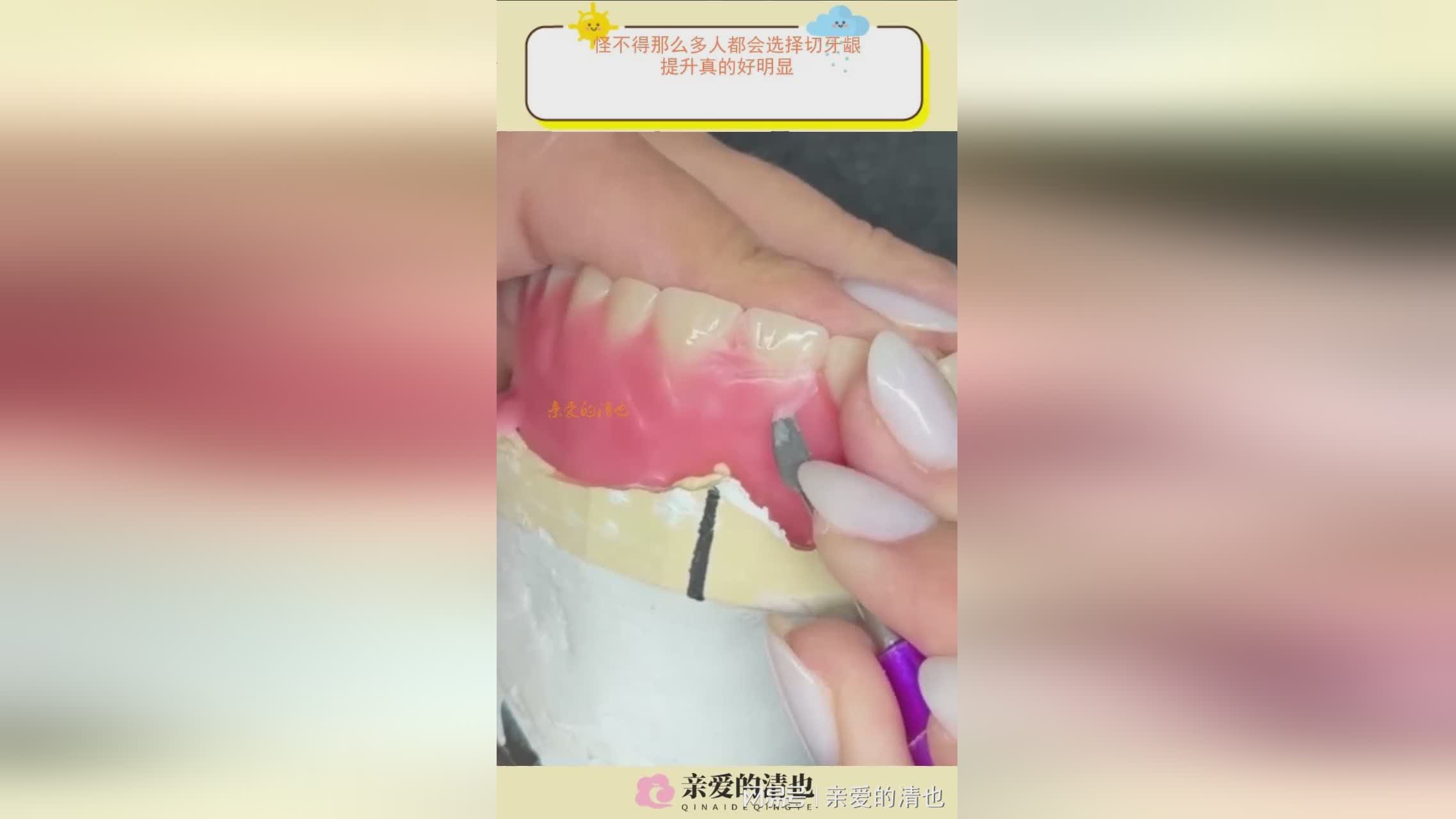图